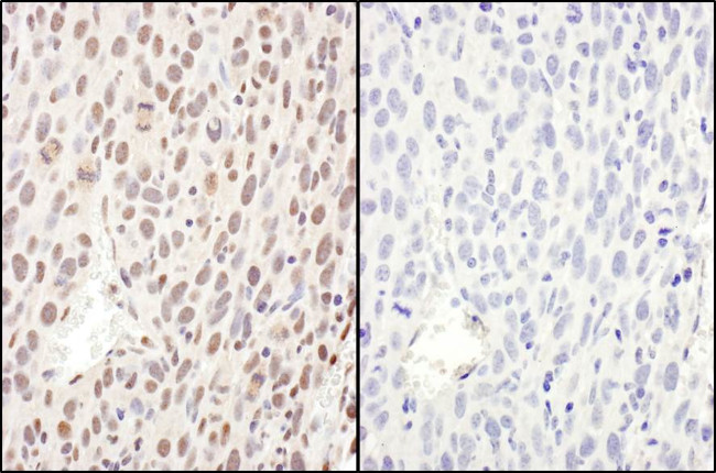 Phospho-RelA (Ser468) Antibody in Immunohistochemistry (Paraffin) (IHC (P))