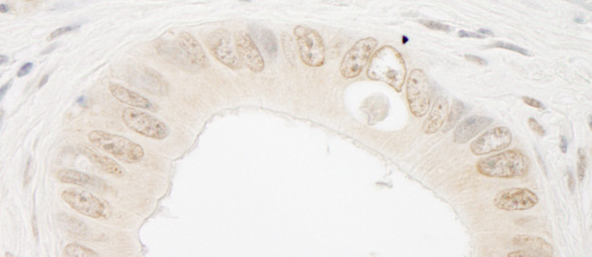 ARIP4 Antibody in Immunohistochemistry (Paraffin) (IHC (P))