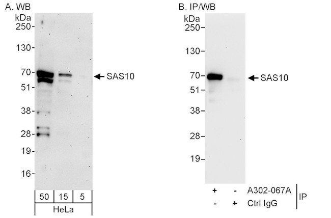 SAS10 Antibody in Western Blot (WB)