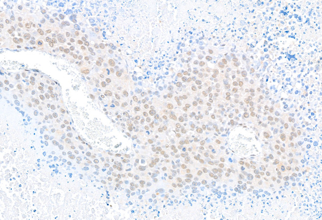 U2AF35 Antibody in Immunohistochemistry (Paraffin) (IHC (P))