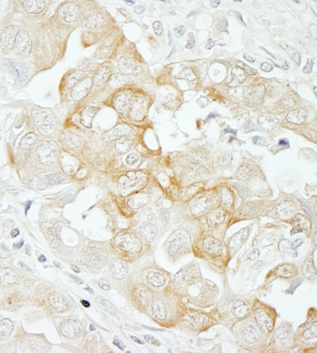 Notch2 Antibody in Immunohistochemistry (Paraffin) (IHC (P))