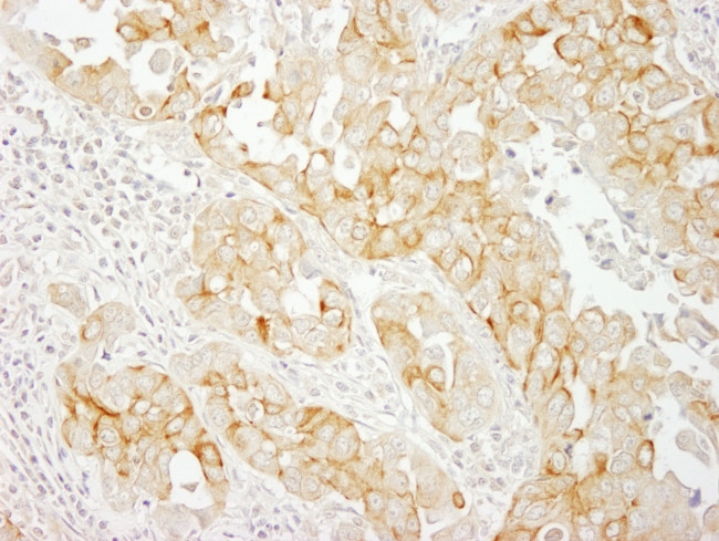 Notch2 Antibody in Immunohistochemistry (Paraffin) (IHC (P))