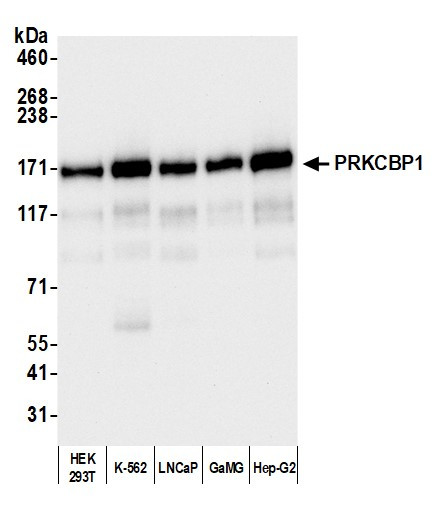 PRKCBP1 Antibody in Western Blot (WB)