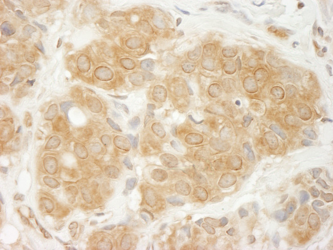 GIT1 Antibody in Immunohistochemistry (Paraffin) (IHC (P))