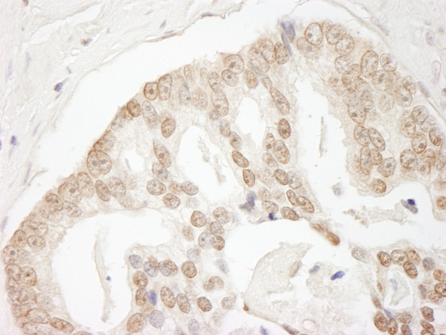 GIT2 Antibody in Immunohistochemistry (Paraffin) (IHC (P))