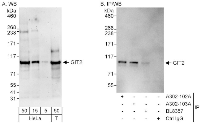 GIT2 Antibody in Western Blot (WB)