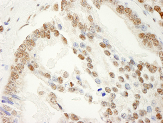 SAM68 Antibody in Immunohistochemistry (Paraffin) (IHC (P))