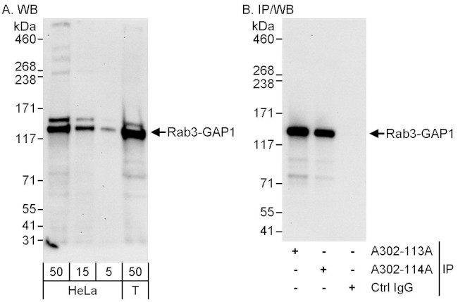 Rab3-GAP1 Antibody in Western Blot (WB)