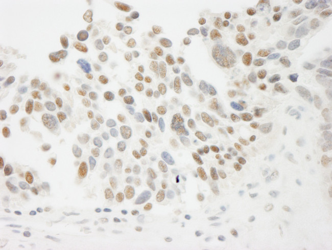 THOC5 Antibody in Immunohistochemistry (Paraffin) (IHC (P))