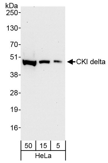 CKI delta Antibody in Western Blot (WB)