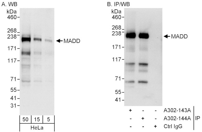 MADD Antibody in Western Blot (WB)