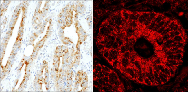 MADD Antibody in Immunohistochemistry (Paraffin) (IHC (P))