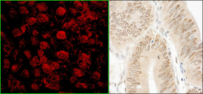 NARG1 Antibody in Immunohistochemistry (Paraffin) (IHC (P))