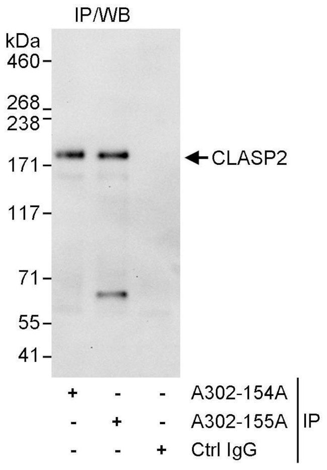 CLASP2 Antibody in Immunoprecipitation (IP)