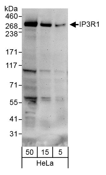 IP3R1 Antibody in Western Blot (WB)