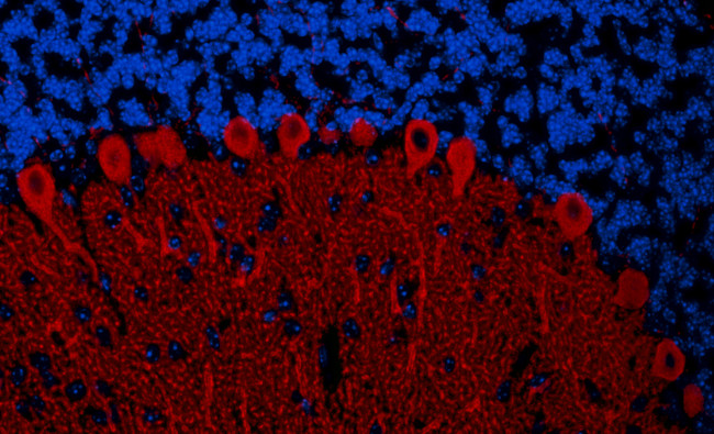 IP3R1 Antibody in Immunohistochemistry (Paraffin) (IHC (P))