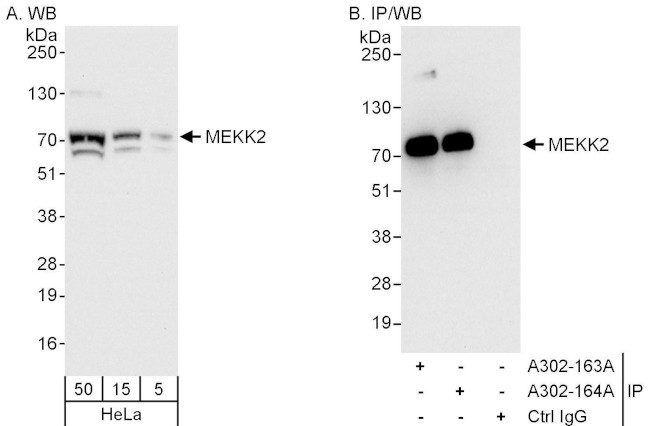 MEKK2 Antibody in Western Blot (WB)