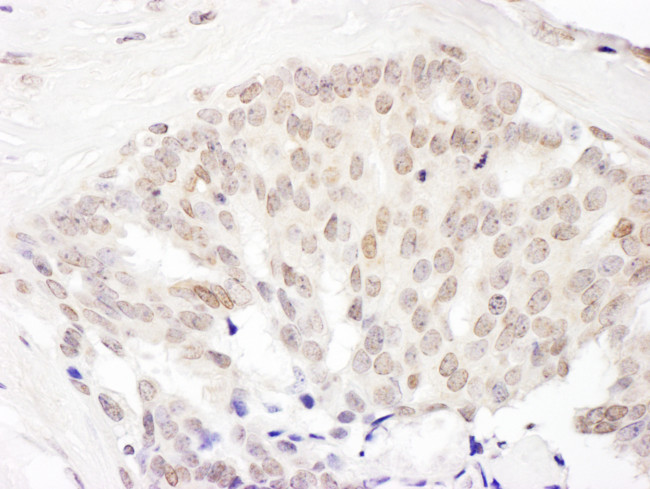 Cul5 Antibody in Immunohistochemistry (Paraffin) (IHC (P))