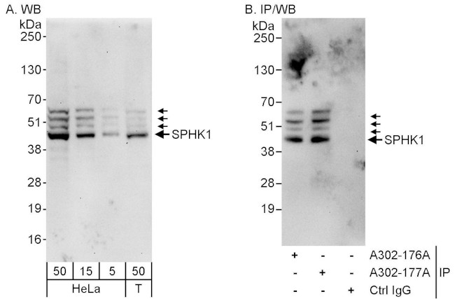 SPHK1 Antibody in Western Blot (WB)