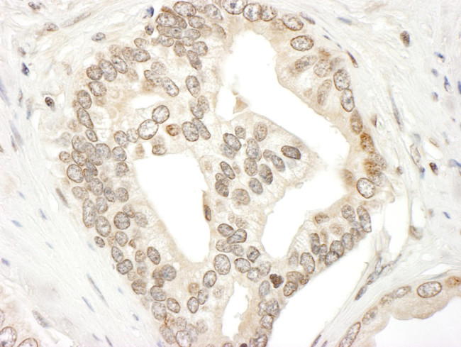 JAK2 Antibody in Immunohistochemistry (Paraffin) (IHC (P))