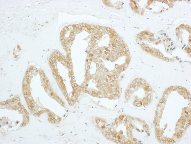 PBK Antibody in Immunohistochemistry (Paraffin) (IHC (P))