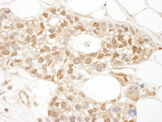 MKL1 Antibody in Immunohistochemistry (Paraffin) (IHC (P))