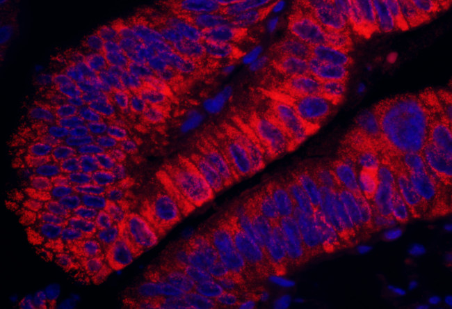 ARHGEF5 Antibody in Immunohistochemistry (Paraffin) (IHC (P))