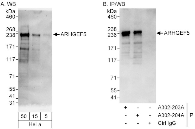 ARHGEF5 Antibody in Western Blot (WB)