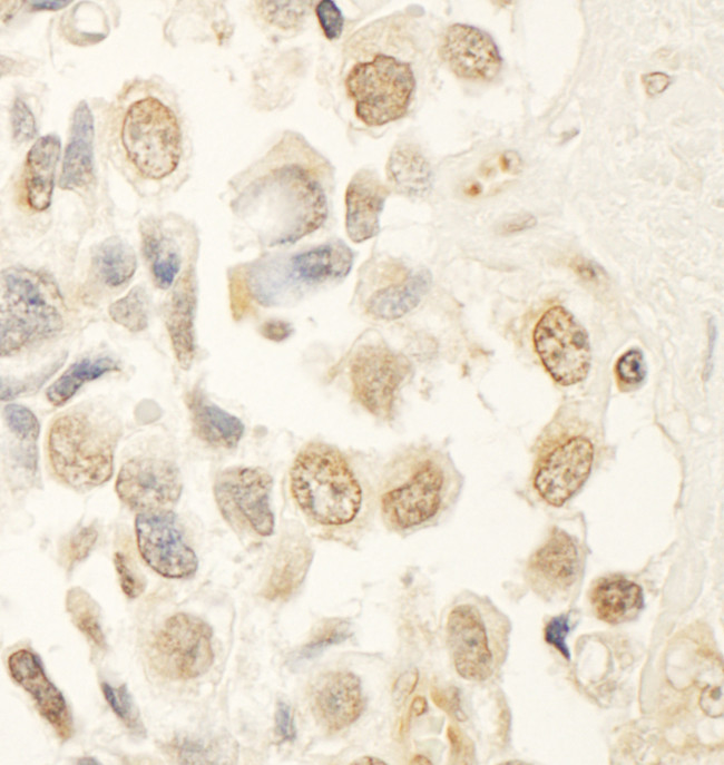 HBO Antibody in Immunohistochemistry (Paraffin) (IHC (P))