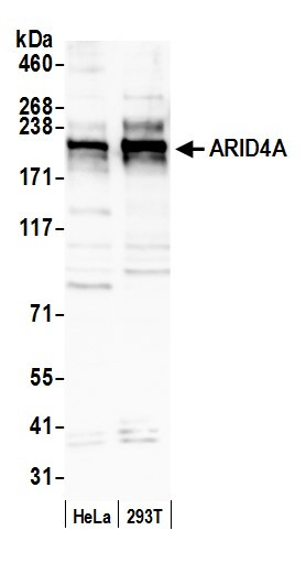 ARID4A Antibody in Western Blot (WB)