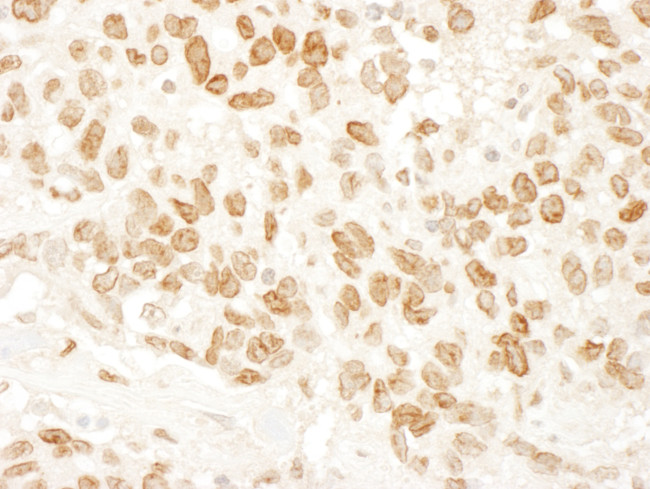 ARID4B Antibody in Immunohistochemistry (Paraffin) (IHC (P))