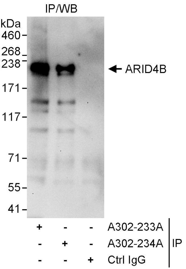 ARID4B Antibody in Immunoprecipitation (IP)