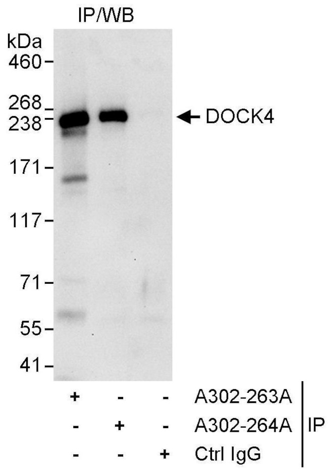 DOCK4 Antibody in Immunoprecipitation (IP)