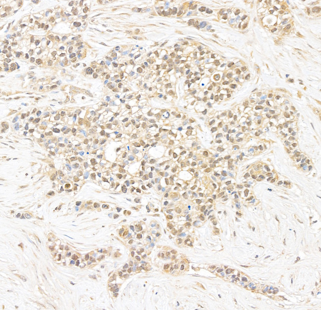 CAP-H2 Antibody in Immunohistochemistry (Paraffin) (IHC (P))