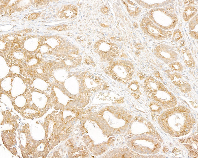 p600 Antibody in Immunohistochemistry (Paraffin) (IHC (P))