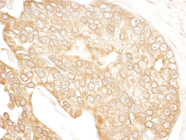 p600 Antibody in Immunohistochemistry (Paraffin) (IHC (P))