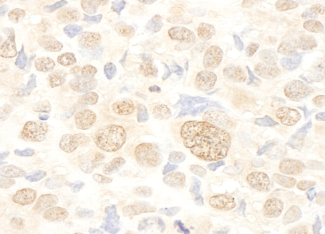 FUSIP1 Antibody in Immunohistochemistry (Paraffin) (IHC (P))