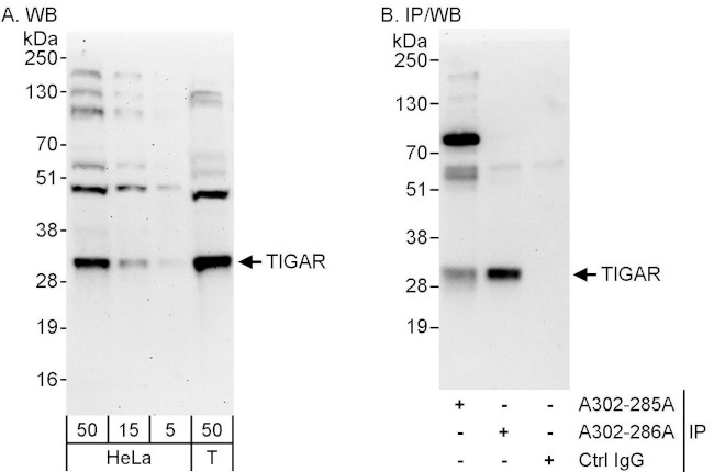 TIGAR Antibody in Western Blot (WB)