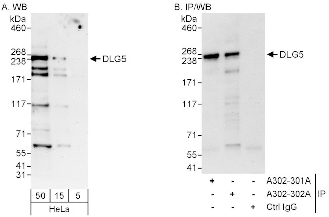 DLG5 Antibody in Western Blot (WB)