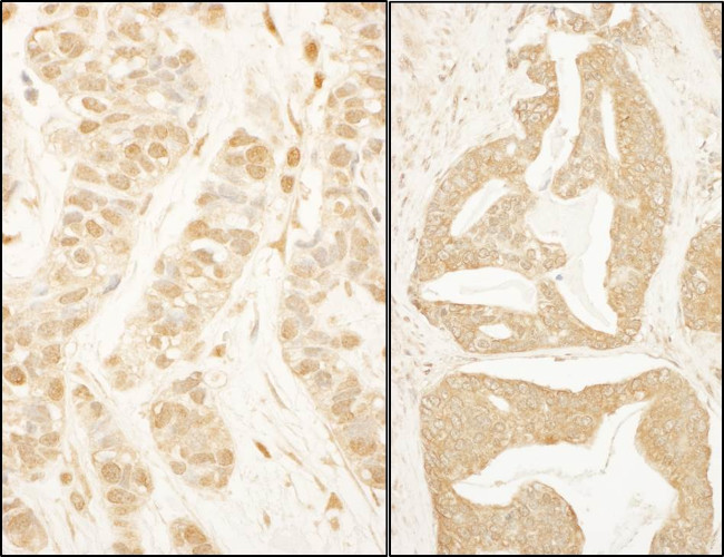 BTF3 Antibody in Immunohistochemistry (Paraffin) (IHC (P))