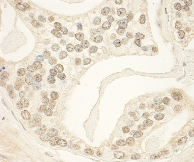 PHF23 Antibody in Immunohistochemistry (Paraffin) (IHC (P))