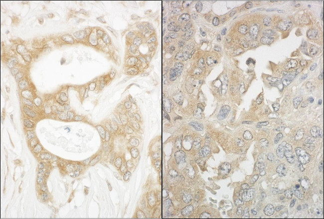 EB1 Antibody in Immunohistochemistry (Paraffin) (IHC (P))