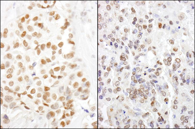 HMGN1 Antibody in Immunohistochemistry (Paraffin) (IHC (P))