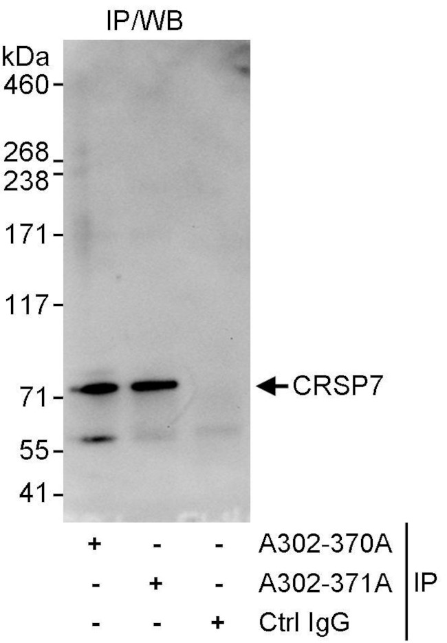 CRSP7 Antibody in Immunoprecipitation (IP)