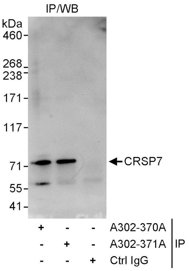 CRSP7 Antibody in Immunoprecipitation (IP)