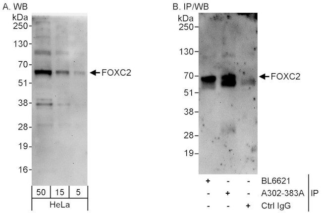 FOXC2 Antibody in Western Blot (WB)