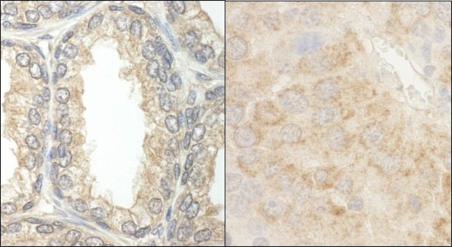 BAD Antibody in Immunohistochemistry (Paraffin) (IHC (P))