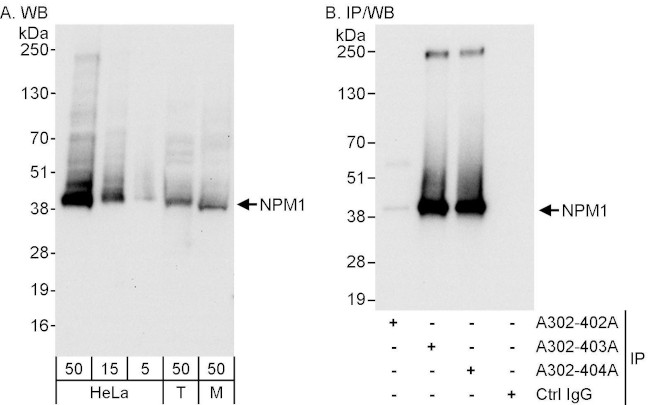 NPM1 Antibody in Western Blot (WB)