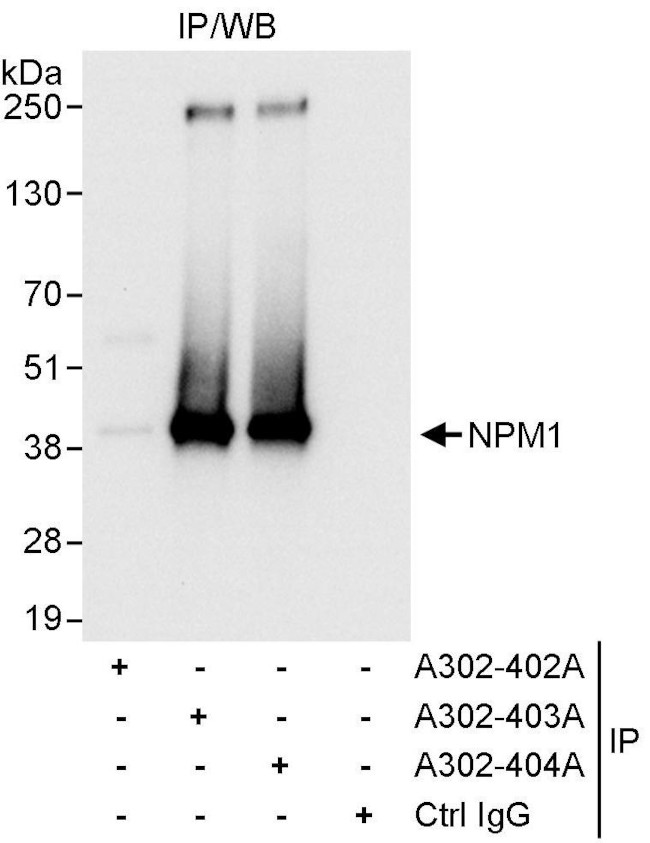 NPM1 Antibody in Immunoprecipitation (IP)