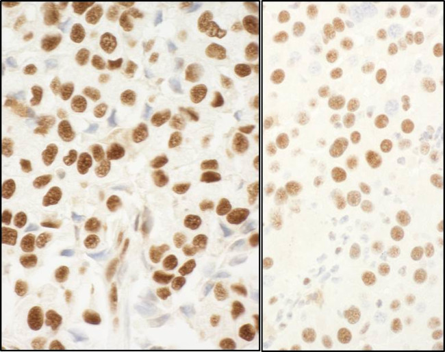 NPM1 Antibody in Immunohistochemistry (Paraffin) (IHC (P))